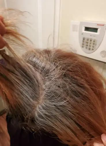 Very very brassy hair
